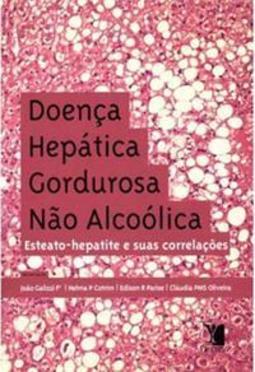 Doença Hepática Gordurosa Não Alcoólica