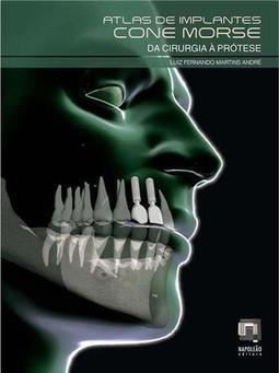 Atlas de Implantes Cone Morse