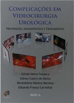 Complicações em Videocirurgia Urológica