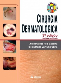Cirurgia dermatologica
