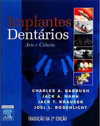 Implantes Dentários
