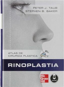 Rinoplastia