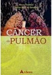 Câncer do Pulmão