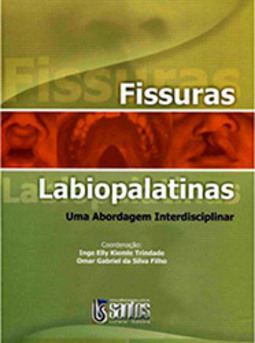 Fissuras Labiopalatinas