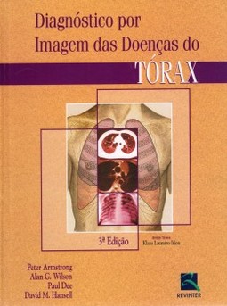 Diagnóstico por imagem das doenças do tórax