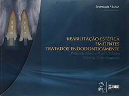 Reabilitação estética em dentes tratados endodonticamente: Pinos de fibra e possibilidades clínicas conservadoras