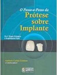 O Passo-a-Passo da Prótese Sobre Implante: da 2ª Etapa Cirúrgica...
