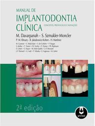 Manual de Implantodontia Clínica