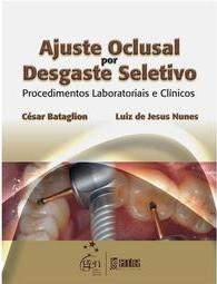 Ajuste Oclusal por Desgaste Seletivo
