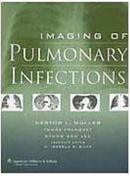 Imaging of Pulmonary Infections - Importado