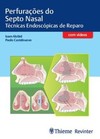 Perfurações do septo nasal: técnicas endoscópicas de reparo