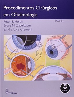 PROCEDIMENTOS CIRURGICOS EM OFTALMOLOGIA