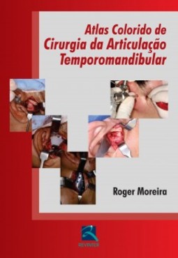 Atlas colorido de cirurgia da articulação temporomandibular