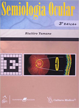 Semiologia ocular