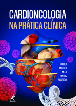 Cardioncologia na prática clínica