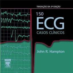 150 ECG