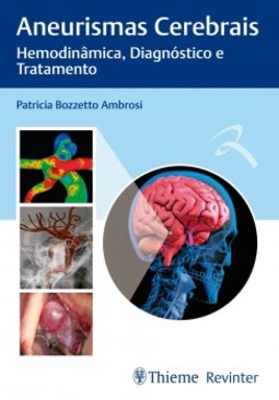 Aneurismas cerebrais: hemodinâmica, diagnóstico e tratamento