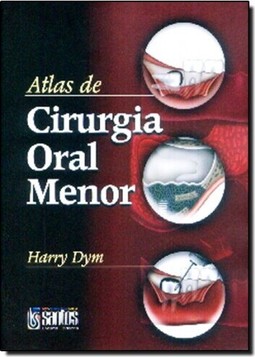 Atlas De Cirurgia Oral Menor