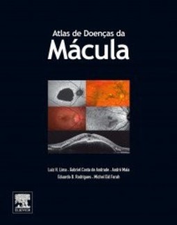 Atlas de doenças da mácula