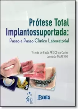 Protese Total Implantossuportada Passo A Passo - Clinico E Laboratorial