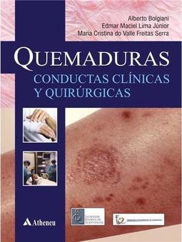 Quemaduras