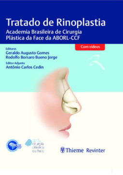 Tratado de rinoplastia: Academia Brasileira de Cirurgia Plástica da Face da ABORL-CCF