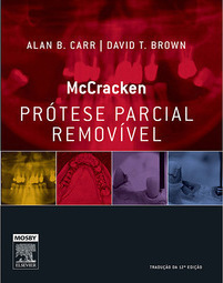 Mccracken Prótese Parcial Removível