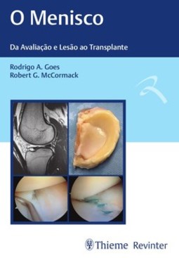 O menisco: da avaliação e lesão ao transplante