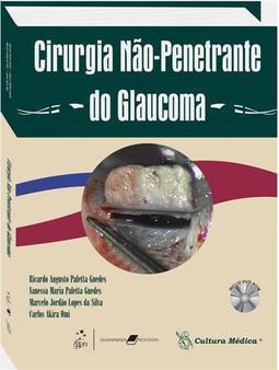 Cirurgia Não-Penetrante do Glaucoma