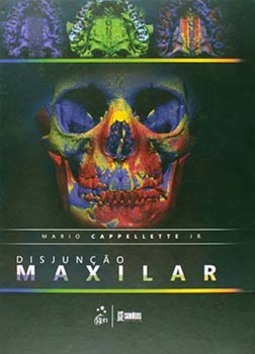 Disjunção maxilar