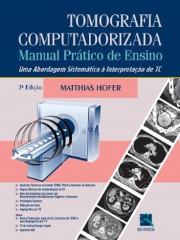 Tomografia computadorizada: manual prático de ensino - Uma abordagem sistemática à interpretação de TC