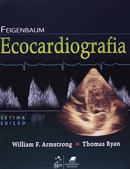 Feigenbaum - Ecocardiografia