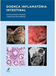 Doença Inflamatória Intestinal