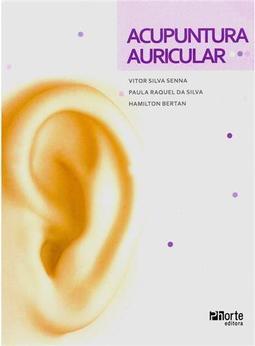 Acupuntura Auricular