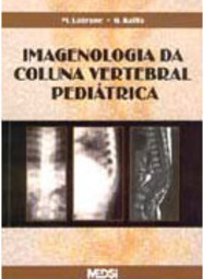 Imagenologia da Coluna Vertebral Pediátrica
