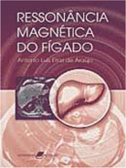 Ressonância Magnética do Fígado