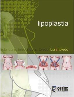 Lipoplastia
