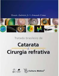Tratado Brasileiro de Catarata e Cirurgia Refrativa