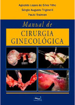 Manual de cirurgia ginecológica