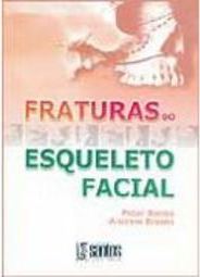 Fraturas do Esqueleto Facial