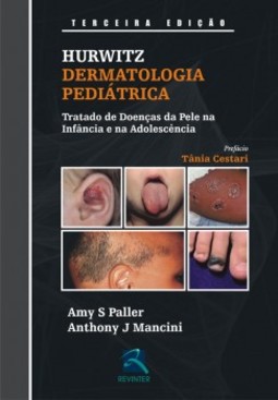 Hurwitz - Dermatologia pediátrica: tratado de doenças da pele na infância e na adolescência