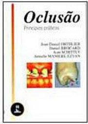 Oclusão