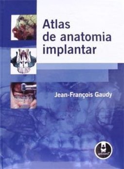 ATLAS DE ANATOMIA IMPLANTAR