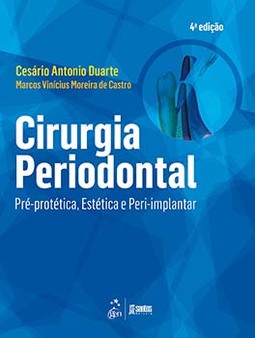 Cirurgia periodontal: Pré-protética, estética e peri-implantar