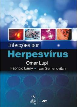 Infecções por Herpesvírus