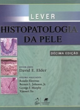 Lever - Histopatologia da pele