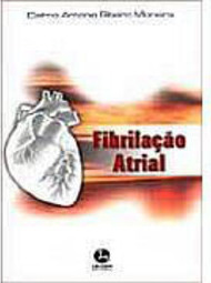 Fibrilação Atrial