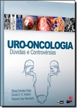 Uro Oncologia Duvidas E Controversias