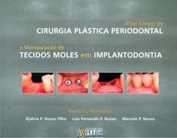 Atlas clínico de cirurgia plástica periodontal: E manipulação de tecidos moles em implantodontia