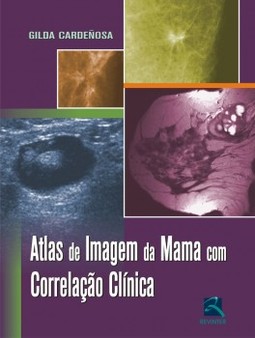 Atlas de imagem da mama com correlação clínica